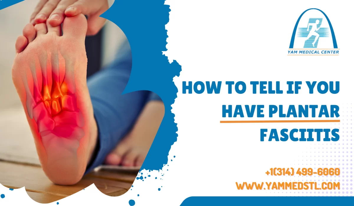 How to Tell If You Have Plantar Fasciitis